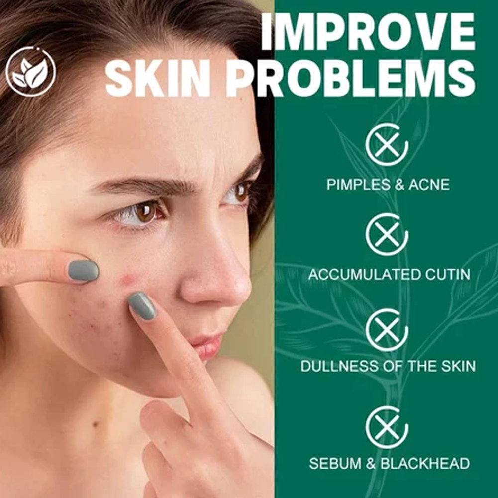 SOME BY MI AHA-BHA-PHA 30 Days - Night Cream recension och pris